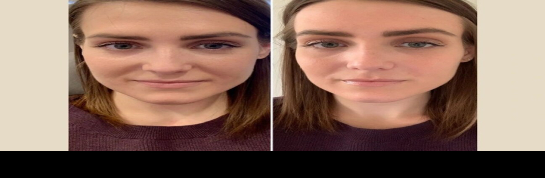 PRP Treatment Dubai Cover Image