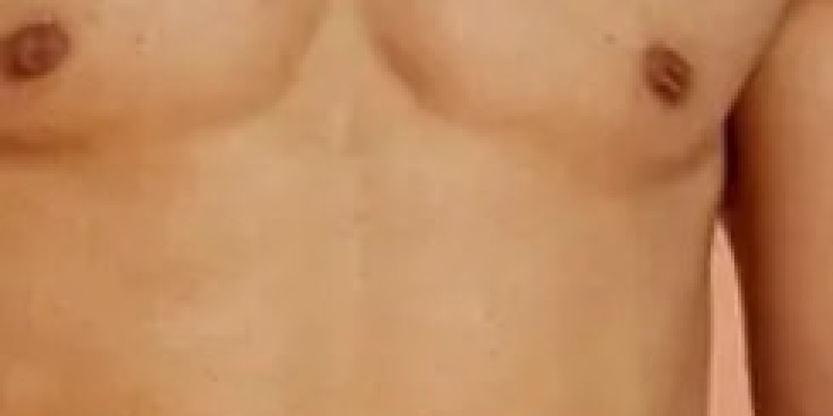 شفط الدهون في جدة للحصول على جسم أكثر تناسقًا