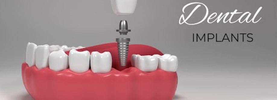 Bigger Smiles Cover Image