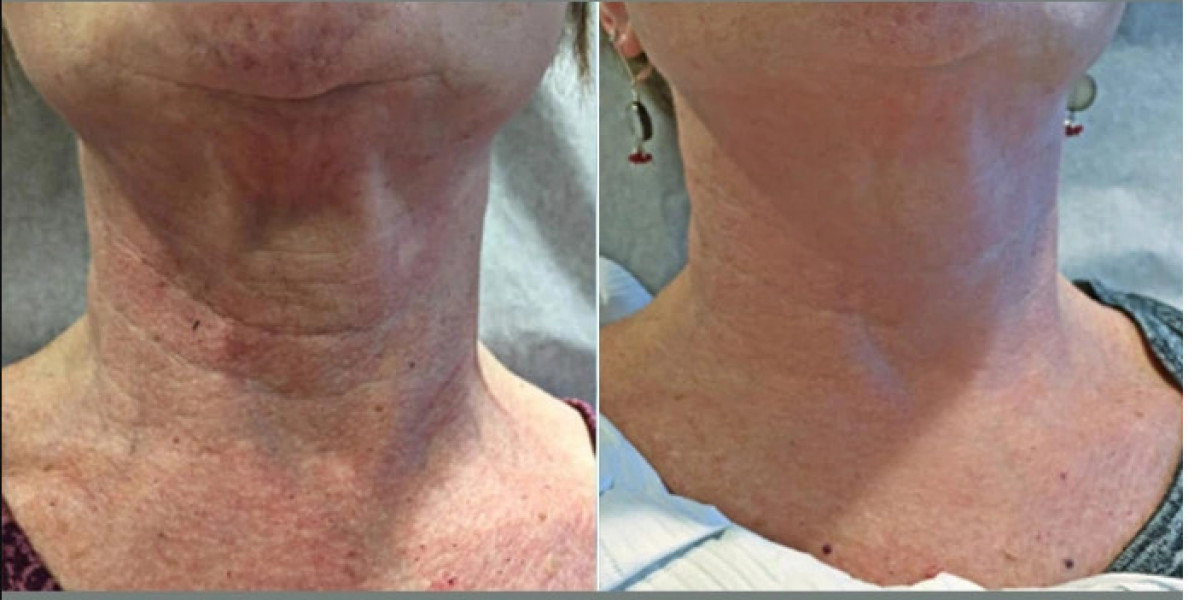 Best Plastic Surgeons in Dubai for High-Precision Skin Tightening