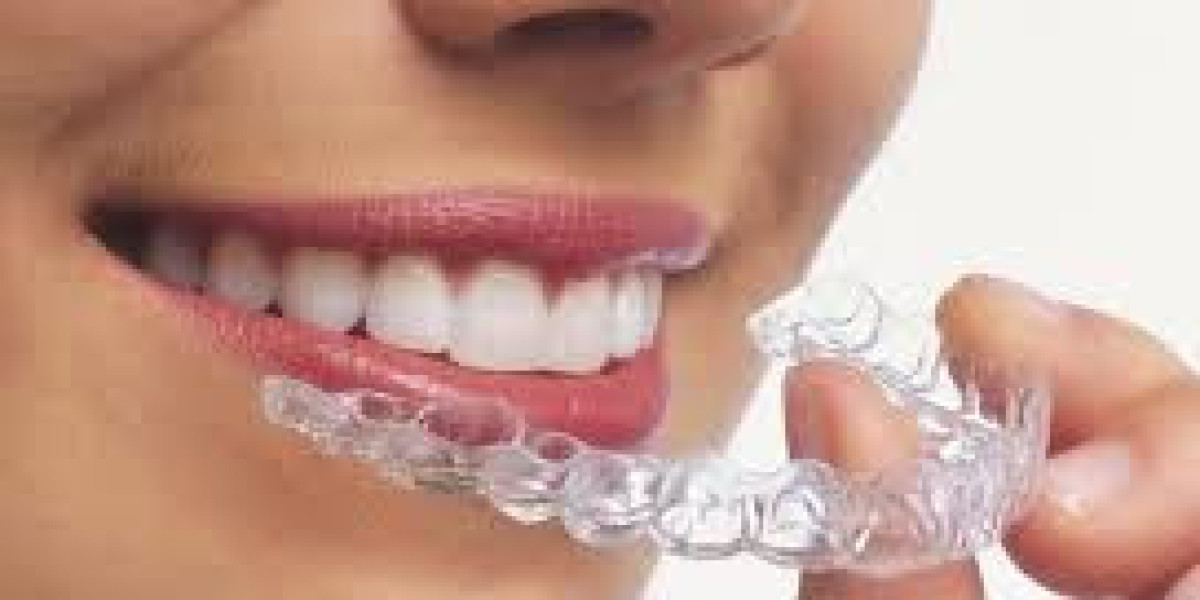 Clear Aligners In Dubai For Perfect Confident Smiles Today