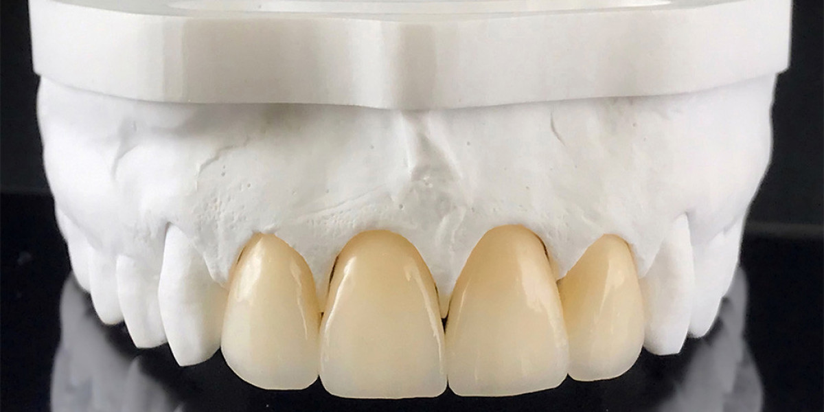 Zirconia Crown Dubai – Durable & Natural-Looking Dental Solutions